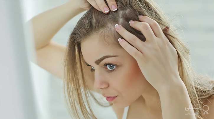درمان ریزش مو ناشی از تیروئید