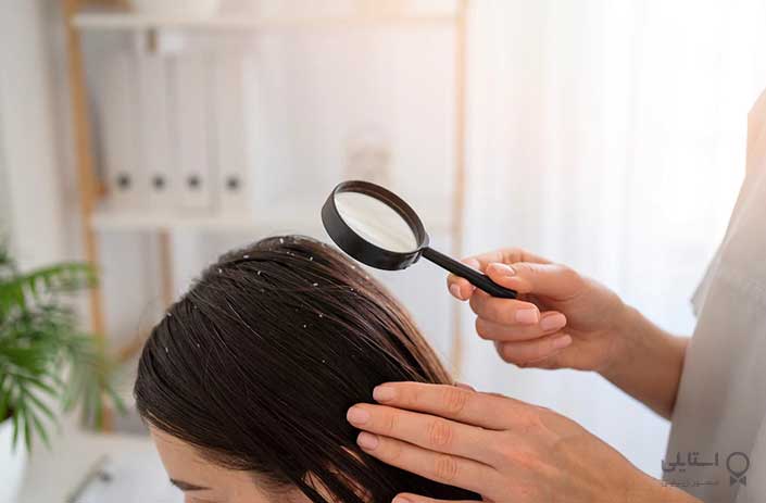 بهترین روغن‌های مو برای شوره‌ی سر؛ کنترل خارش و پوسته پوسته شدن