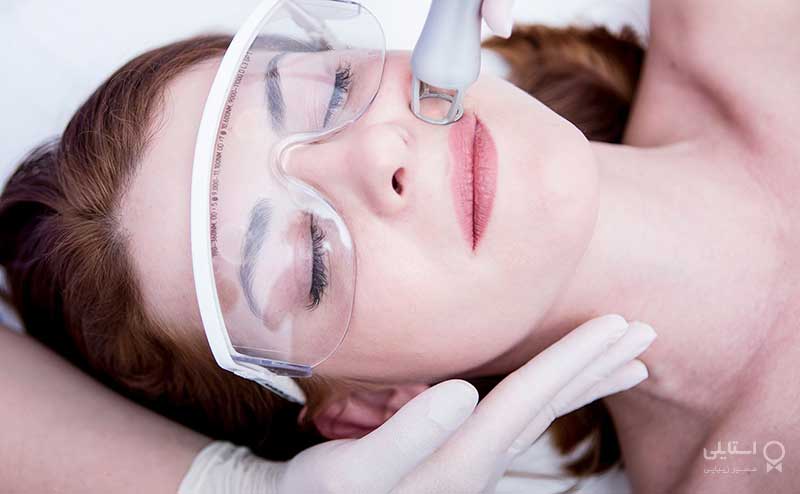 روش لیزر درمانی  برای صورت