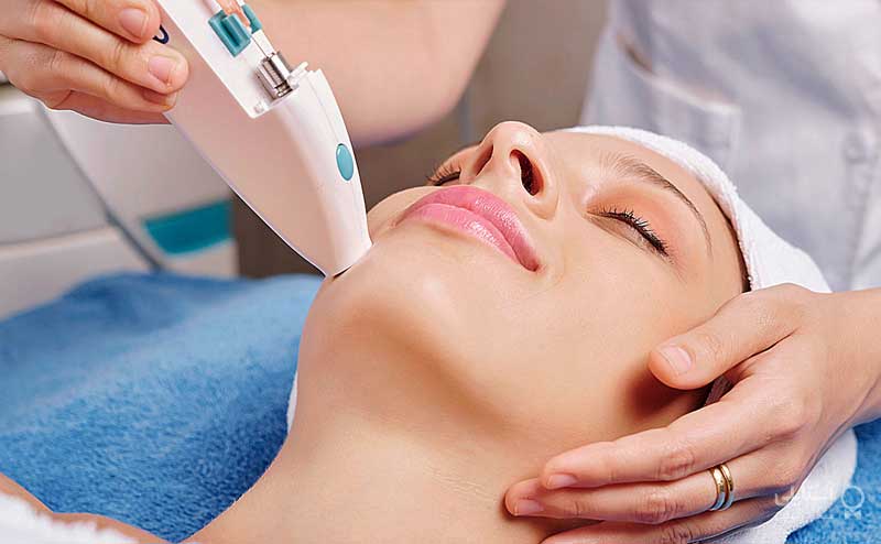 روش لیزر درمانی  برای صورت