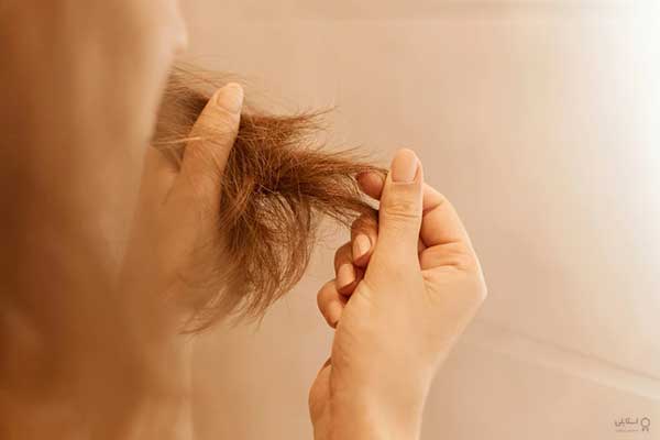 علت و نحوه‌ی درمان موهای چرب