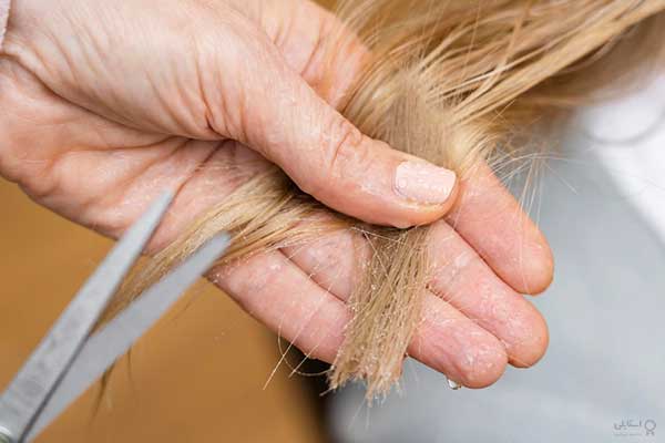تخلخل مو: انواع، علل، و نحوه‌ی تعیین سطح آن