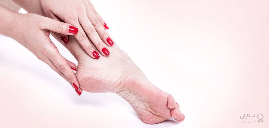 3 روش برای از بین بردن پوسته‌های مرده کف پا