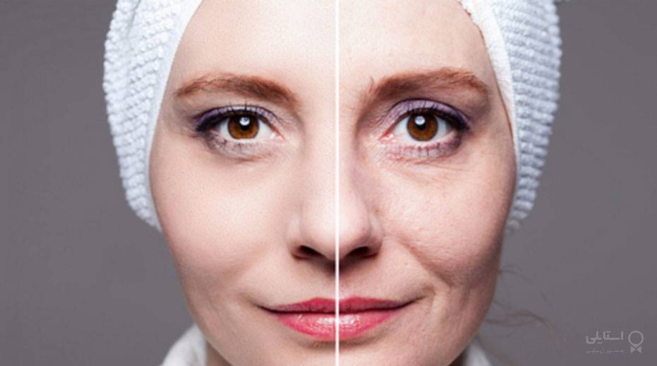 15 درمان خانگی موثر برای منافذ باز پوست