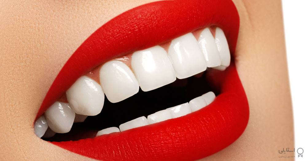 دندان‌های سفید با 9 روش طبیعی