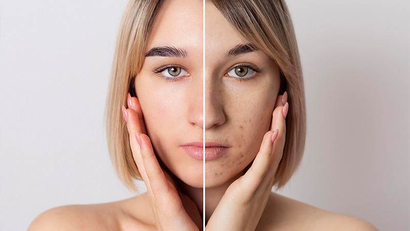 6 راه طبیعی برای درمان لکه‌های قرمز روی پوست