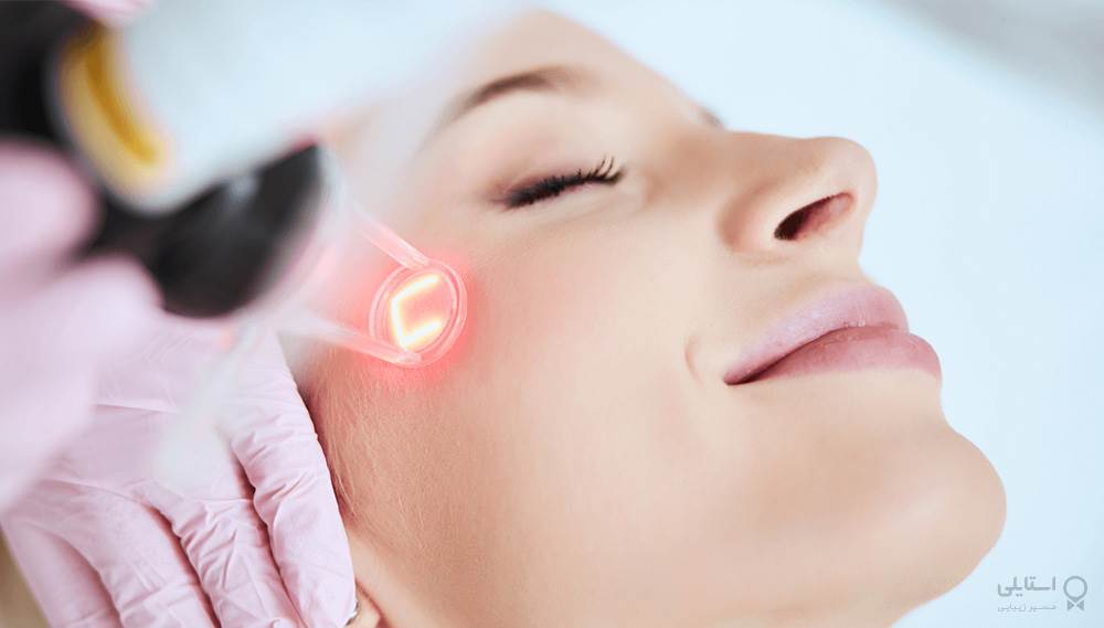 5 روش لیزر درمانی  برای صورت