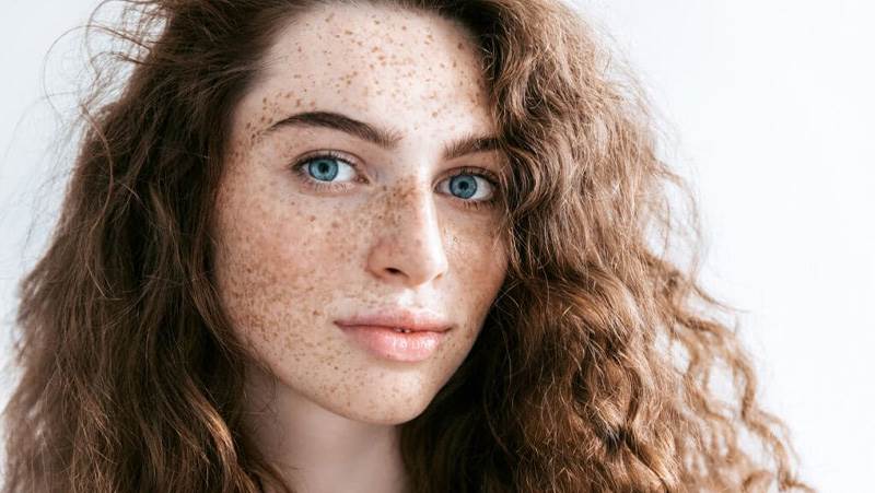 14 درمان خانگی برای از بین بردن رنگدانه‌های پوست