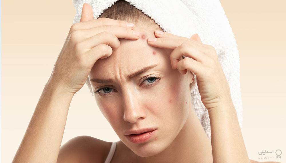 6 درمان خانگی برای از بین بردن لکه‌های تیره روی صورت